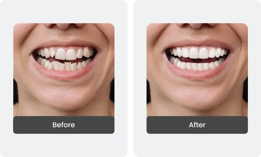 Before and After