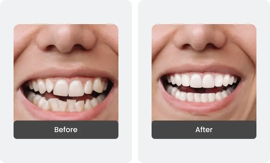 Before and After