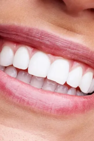 Full Mouth Rehabilitation