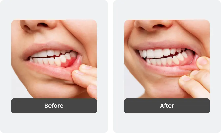 Before and After