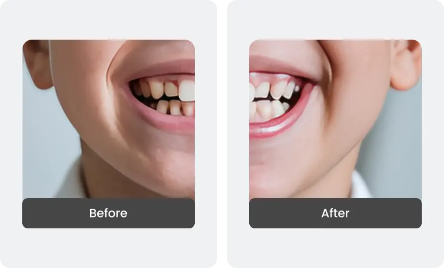 Before and After