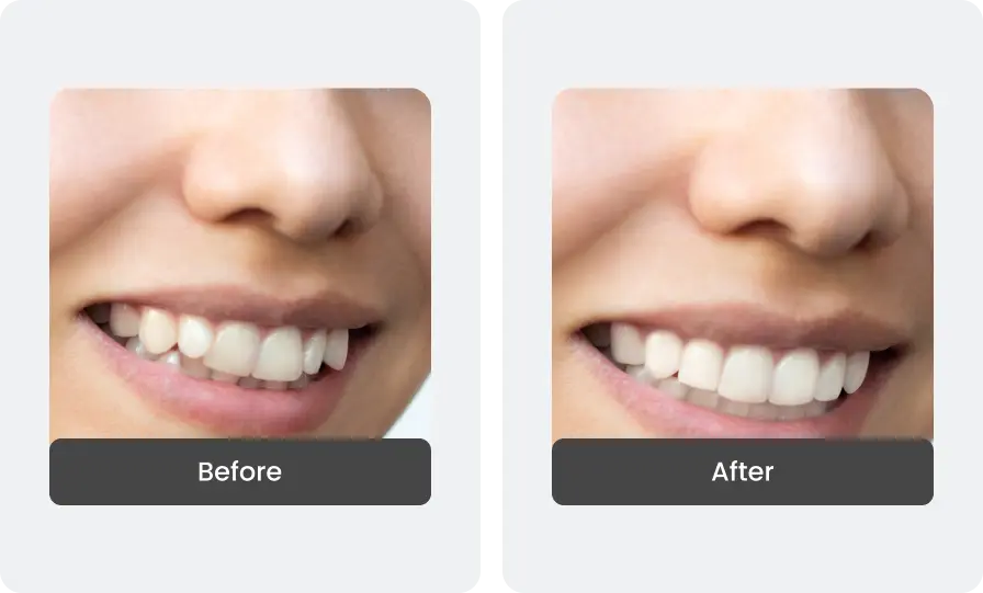 Before and After