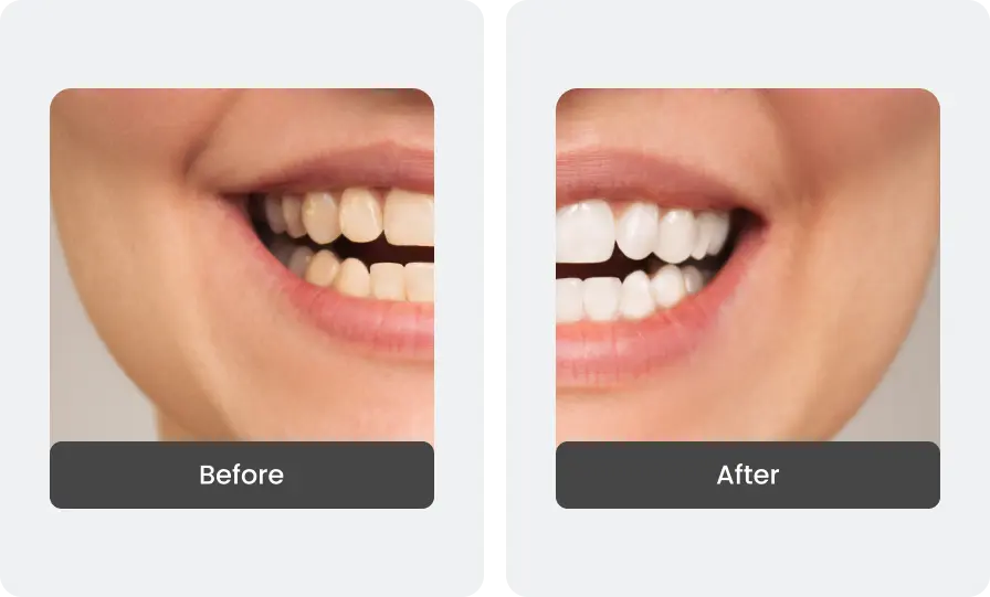Before and After