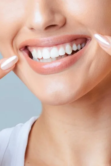 Teeth Whitening