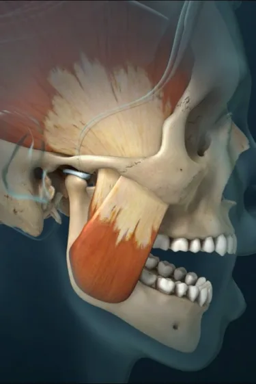 TMJ Disorders