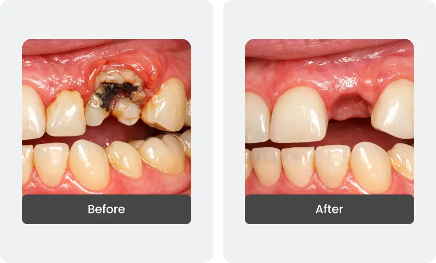Before and After