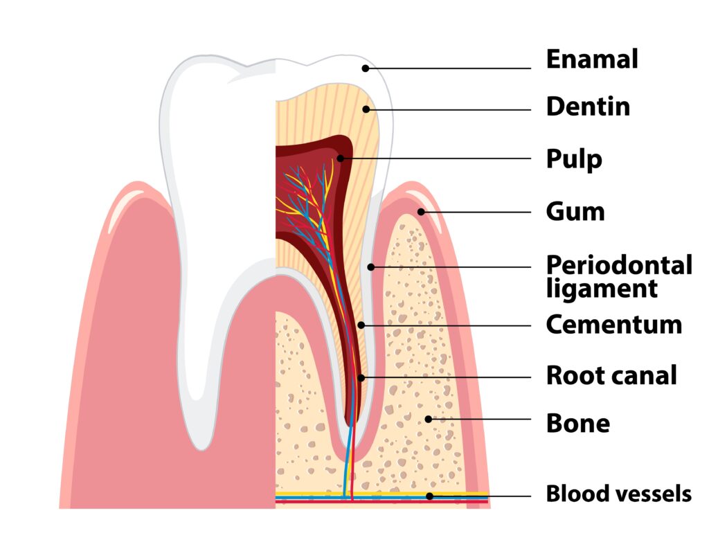 Diagram showing the anatomy of a human tooth including enamel, dentin, and pulp, illustrating areas vulnerable to tooth decay.