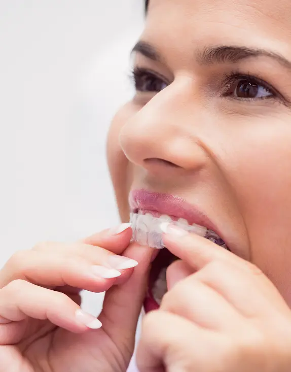 Invisalign