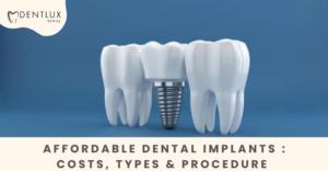Dental implant